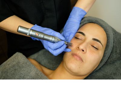 DermaPen intensieve Microneedling DermaPen intensieve Microneedling